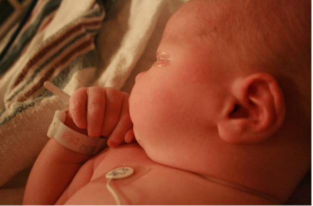Ma fille a manqué d'oxygène à la naissance